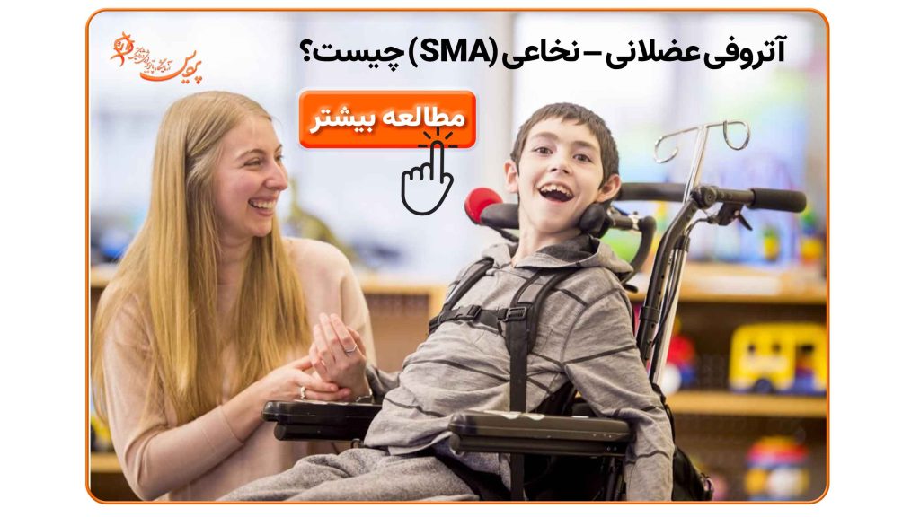 تصویر مرتبط با آتروفی عضلانی–نخاعی (SMA)، بیماری ژنتیکی باعث ضعف عضلات و تحلیل عضلانی می‌شود، تشخیص با آزمایش ژنتیک SMN1.
