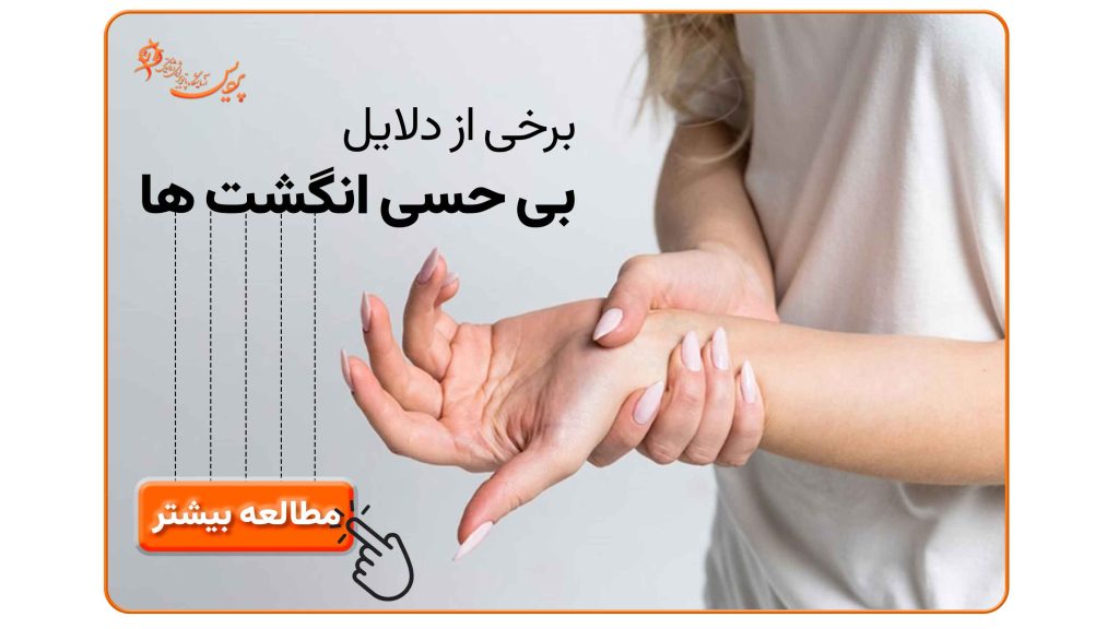 تصویر دست با بیحسی و گزگز در انگشتان، نشاندهنده سندرم تونل کارپ و نوروپاتی محیطی.