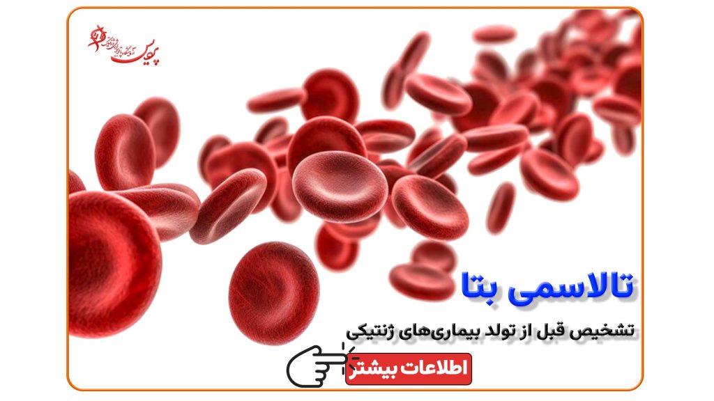 تشخیص پیش از تولد تالاسمی بتا با نمونه‌برداری از جنین و بررسی ژن‌های والدین در آزمایشگاه پردیس مشهد.