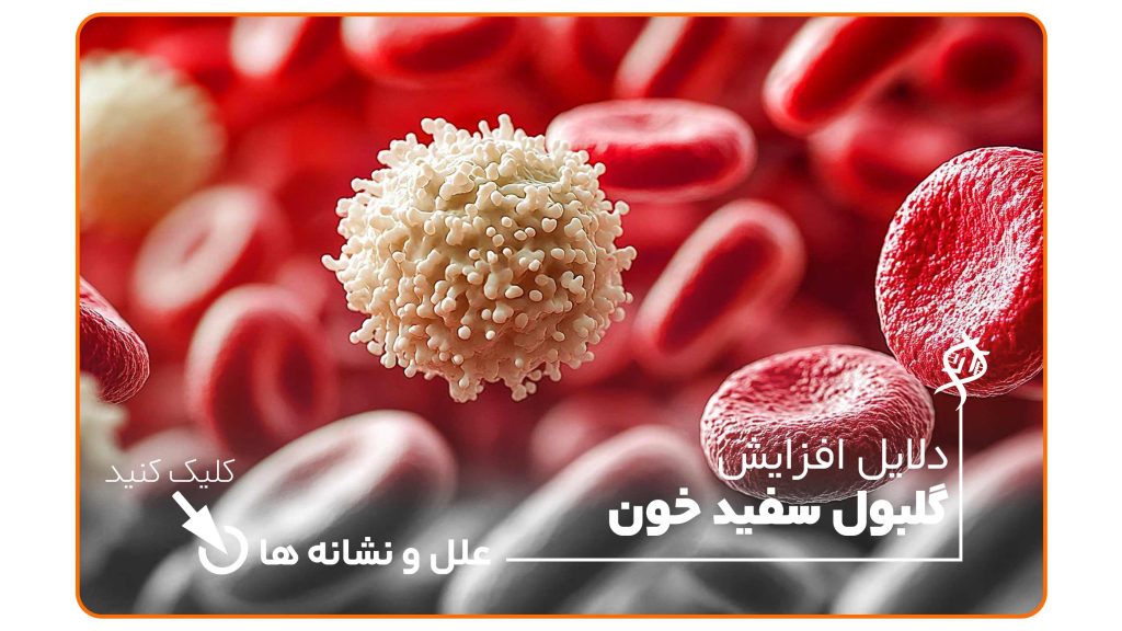 نمای میکروسکوپی از گلبول سفید خون (WBC) در میان گلبول‌های قرمز؛ نشانه‌ای از افزایش گلبول سفید در پاسخ به عفونت یا التهاب