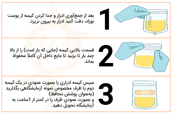 تصویر روش صحیح جمعآوری ادرار نوزادان با استفاده از کیسه جمعآوری یا پوشک مخصوص، به منظور نمونهگیری بهداشتی