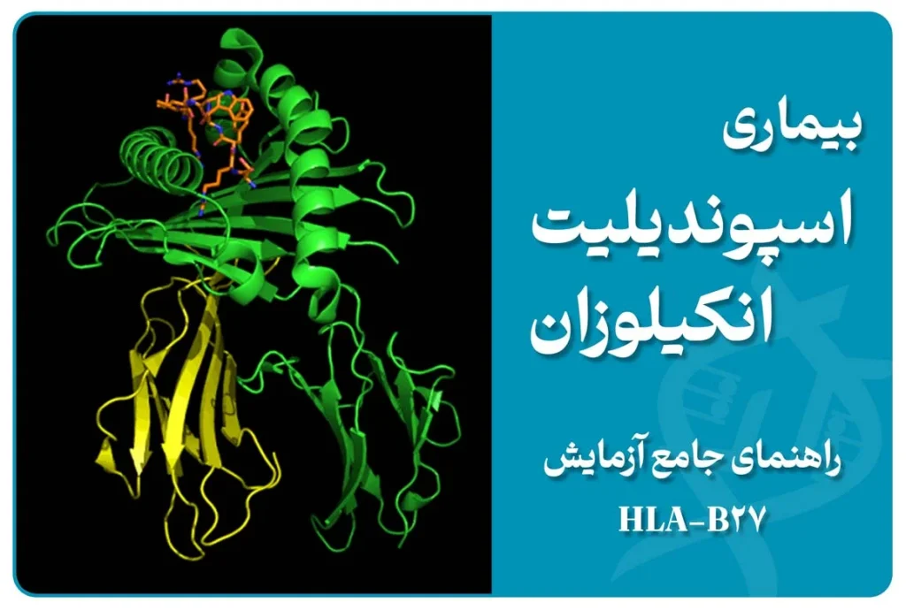 “نمایش گرافیکی التهاب ستون فقرات و تاثیر ژن HLA-B27 در بیماری اسپوندیلیت انکیلوزان”