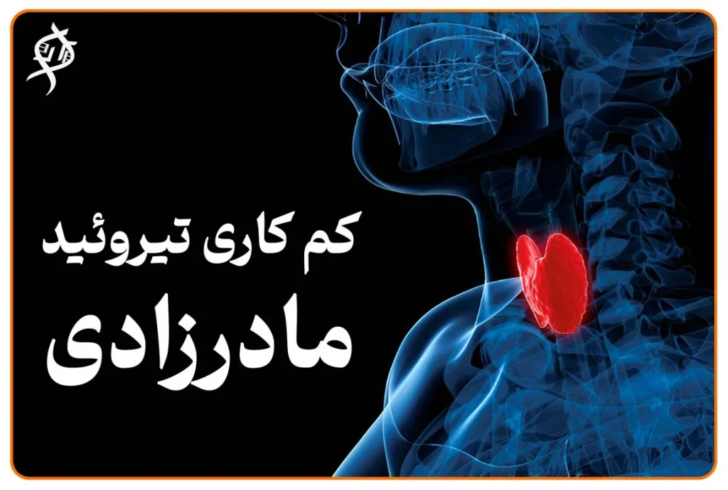 راهنمای والدین درباره کم‌کاری تیروئید مادرزادی، غربالگری نوزادان و درمان با لووتیروکسین برای پیشگیری از اختلال رشد
