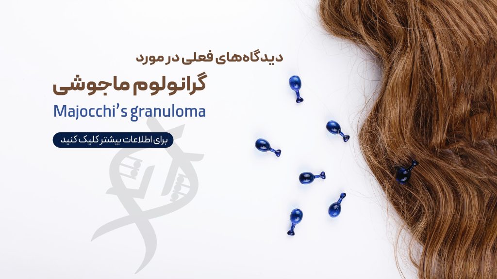گرانولوم ماجوشی